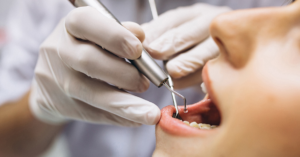 Common Dental Problems and Their Solutions